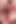 215 derin anal