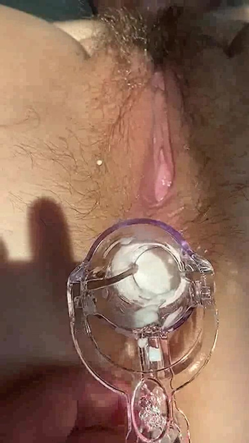 THEY INSERT AN ANAL SPECULUM INTO MY HAIRY ANAL HOLE AND FUCK ME IN THE ASS. MY ANAL BECOMES CAPACIOUS, WHITE CREAM ASSHOLE. | Clip 1