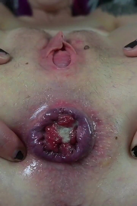 JOI Anal Prolapse and Gape