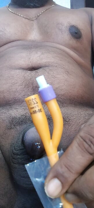 Big Catheter NO. FR 22 Can any imagine? 40ml water inflate the balloon.