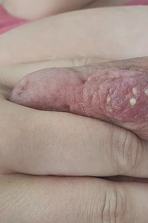 Hand Expressing