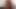 Squatting and asshole winking TEASER