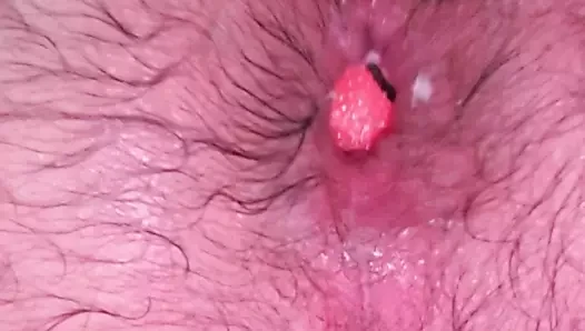 anal top