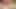 Prickelsucht TEIL 2 mehr brennnesseln plus zahnpasta, wichsen und pissen