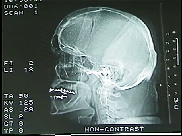 Anal exam during shemale physical