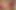 POV View of Masturbating My Prolapse Pussy in My New Hot Lingerie