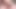 Foreskin movement (slowmotion) 402
