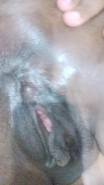 Enge löcher pulsieren