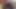 フィスティングセッション