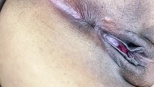 Furzende pOV-zusammenstellung