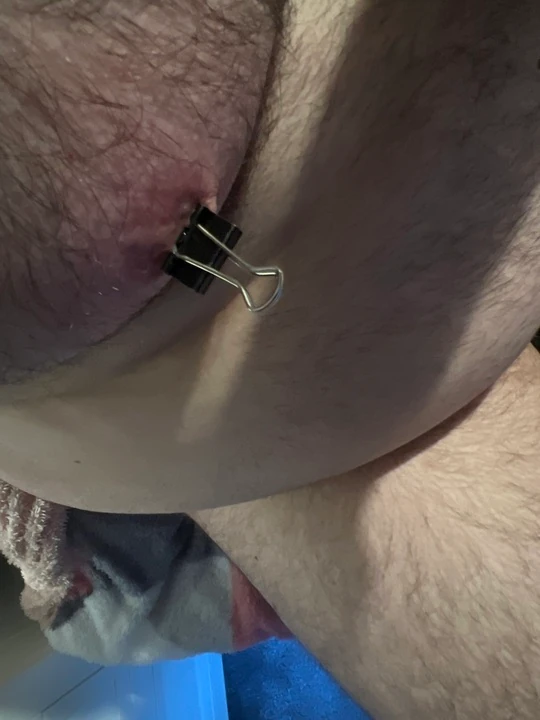Nipple clamps removed after thirty minutes and more clamps added