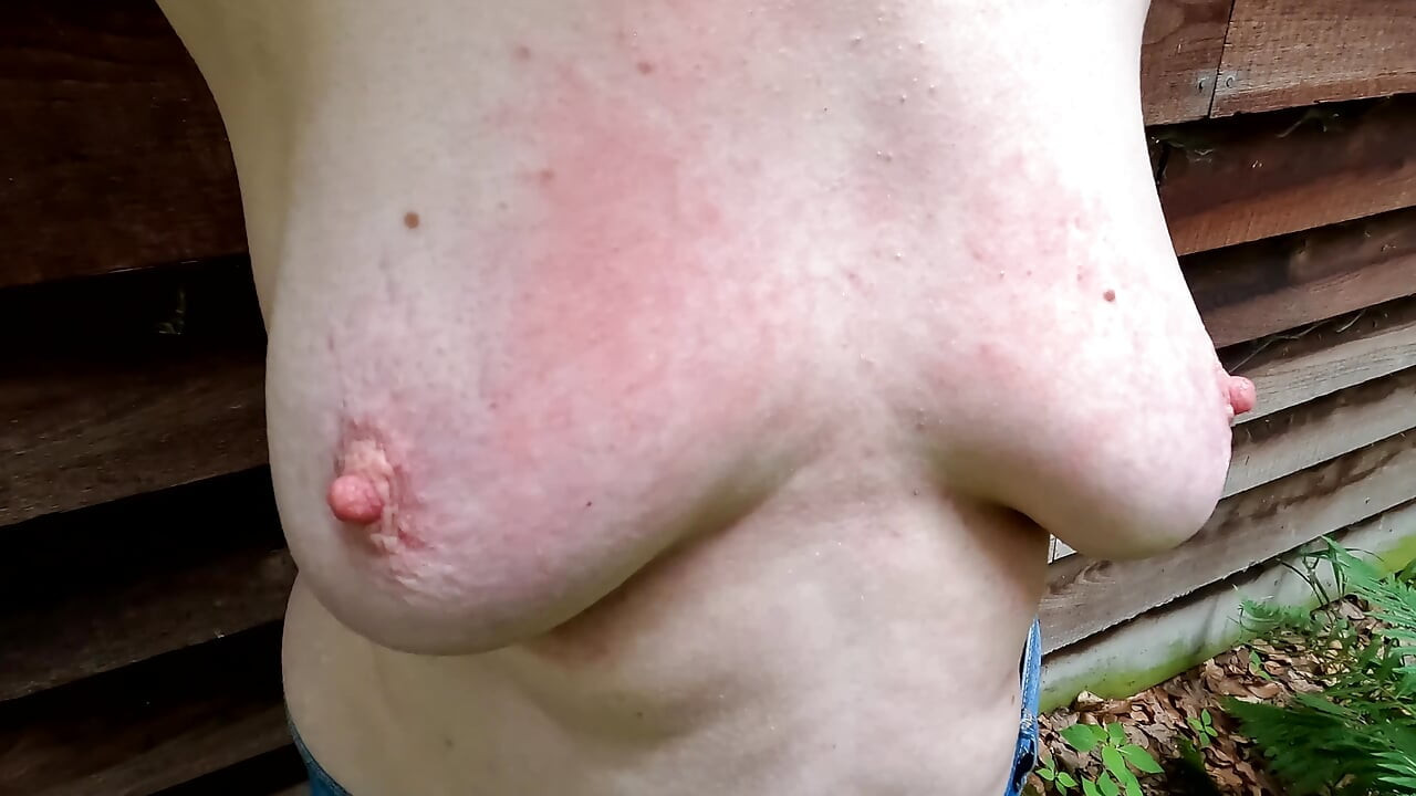 젖가슴을 핀에 넣어