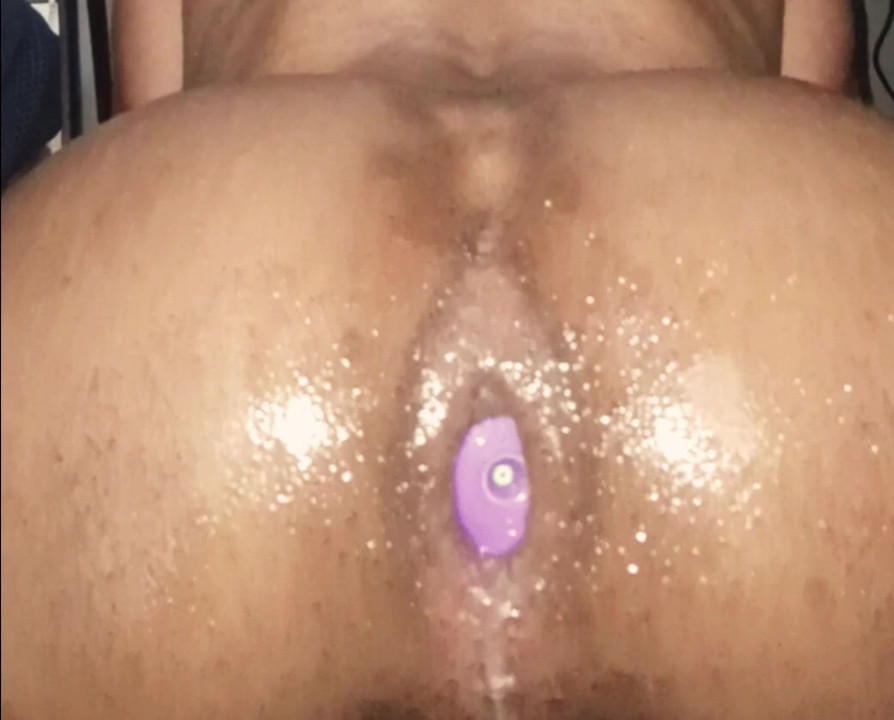 Anal Gaping