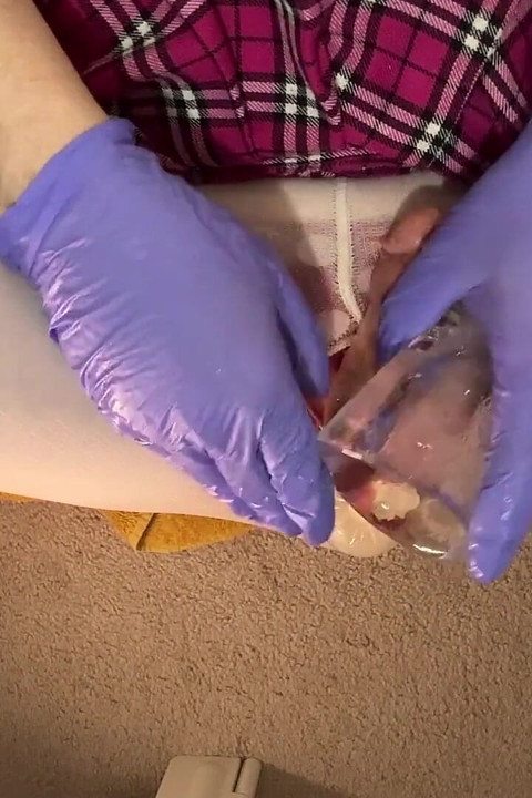Ice Melt