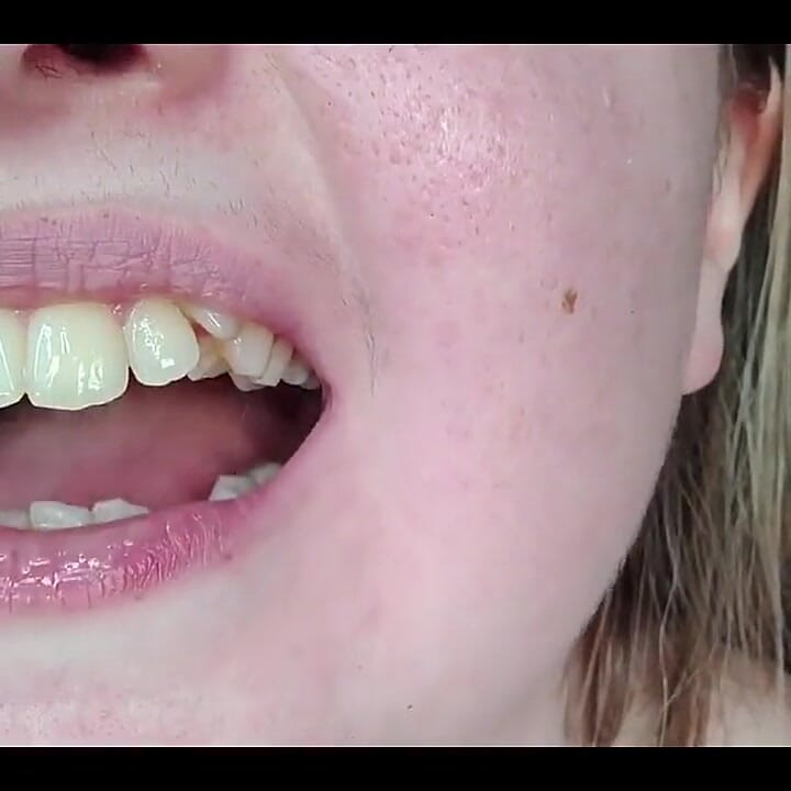 私の口、歯、舌、喉を間近で