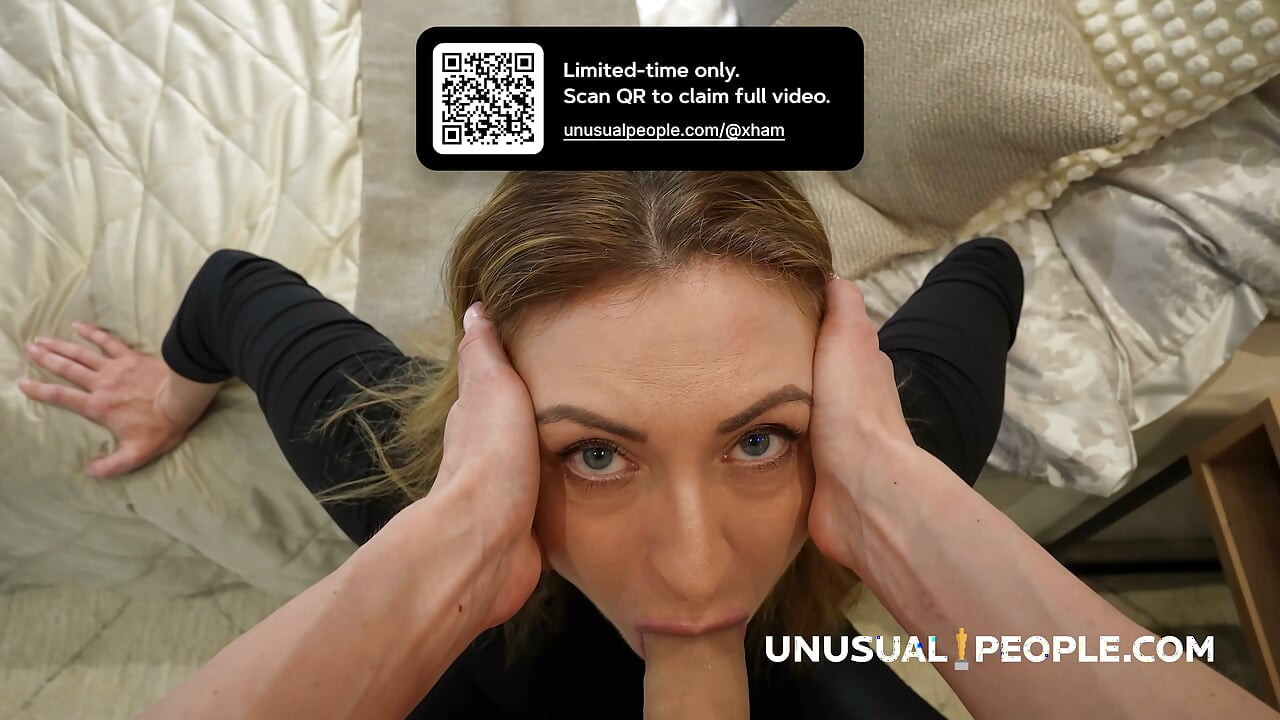 Amazing Born-Penis Anomaly in Girl Supermodel (Unusual People)