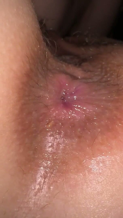 HAIRY TEENAGE (18 y.o.) GIRL MET FIRST TIME MY TONGUE 👅 IN HER BUTTHOLE | Clip 1