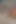 Sounding Hubby's Dick with Huge 30 Cm Dilator. Cum Blocking for 2 Minutes - No Cumming Till I Decide