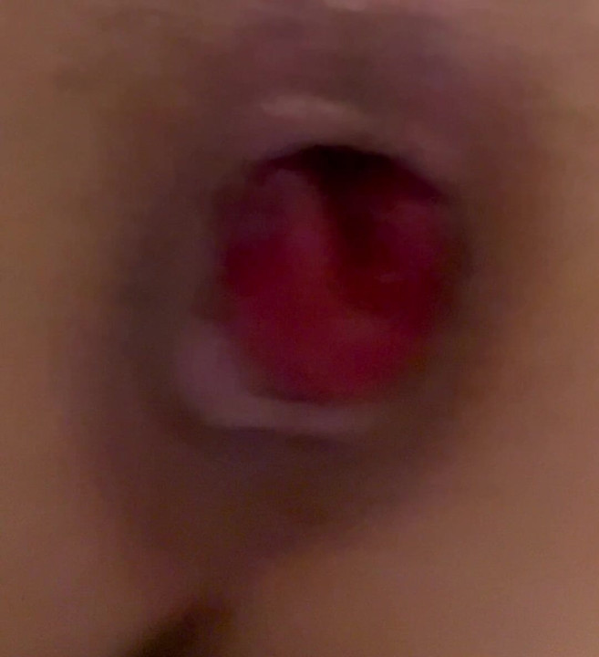 Anal Ripping, Rectal Propulsion