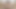 Lizzy Yum July 2023 Just Gas Me Post-op Orgasm Pussy Clit Masturbation Teasing Orgasm