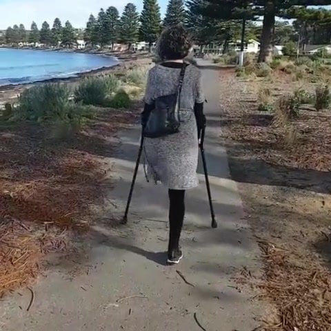 Amputee