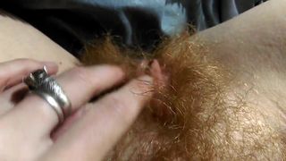 hairy redhead