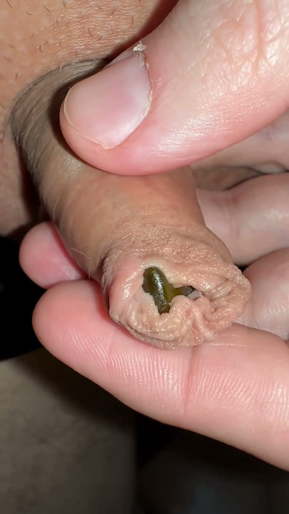 juicy small cock foreskin games | Clip 1