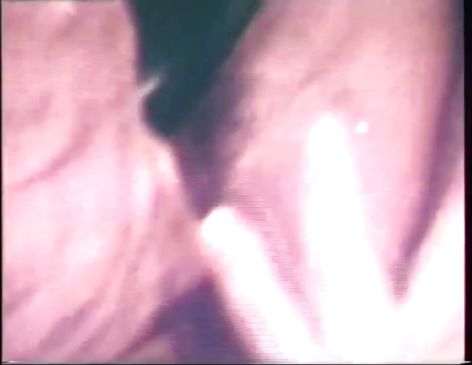 Everyone Inside My Ass