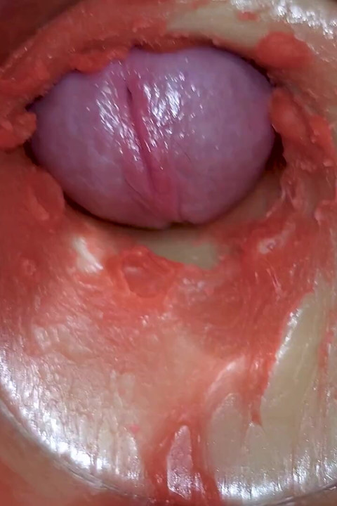Camera Inside Deep Pussy Captures Huge Ejaculation of Sperm 4K