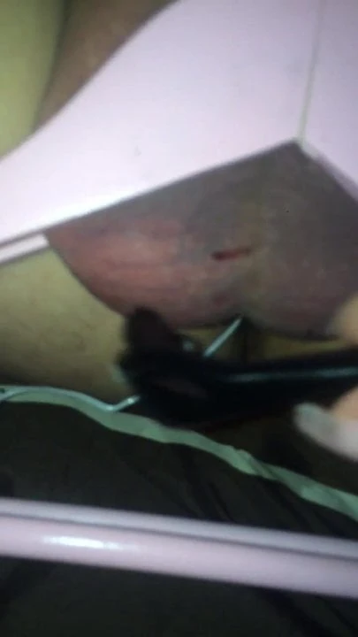 Fustigazione del pene