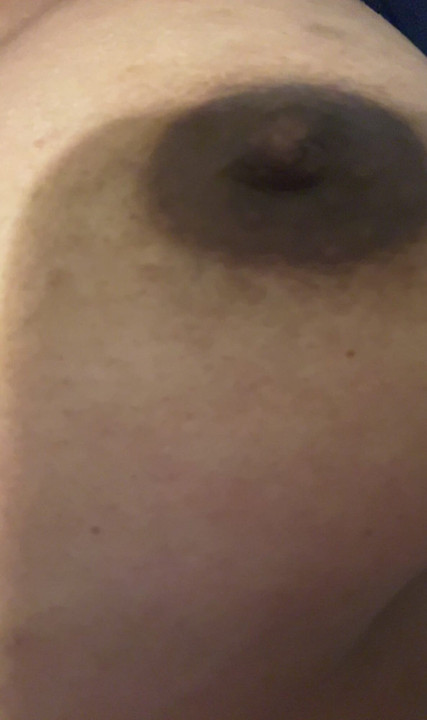 Black nipples