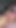 Emotional moment from "The nipple, with large lips, diligently sucks the"