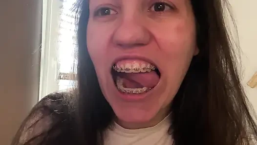 Dilinizle diş teli yalamak