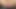 Sizequeen CrazyWifeSlut's huge pumped cunt stretched and squirting