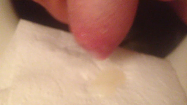 Foreskin pullback