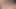 Pandora ve Matilda'nın cinsel hastalarıyla inanılmaz