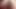 First Double Penetration! DP and Big Prolapse by Cute Teen