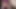 Foreskin movement (slowmotion) 779
