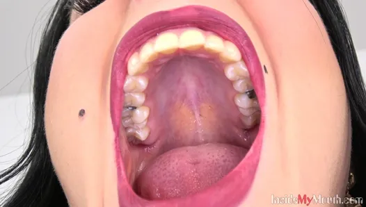 Inside My Mouth