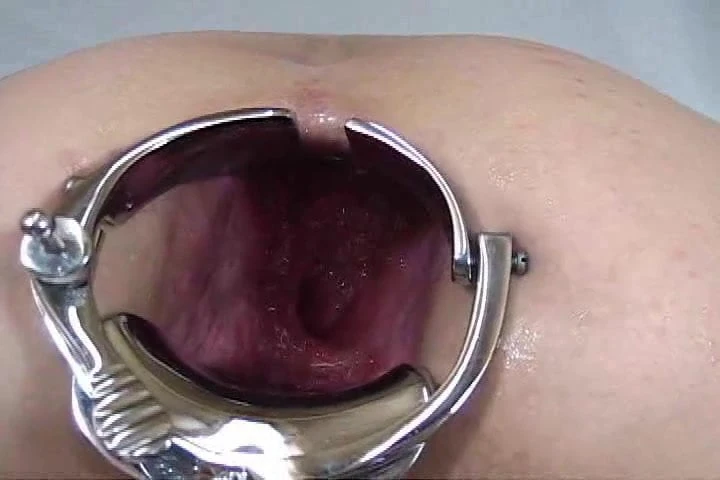 La femme d'Elmer se fait fister le spéculum anal 2