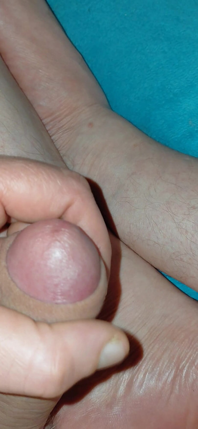 Washing feet with sperm