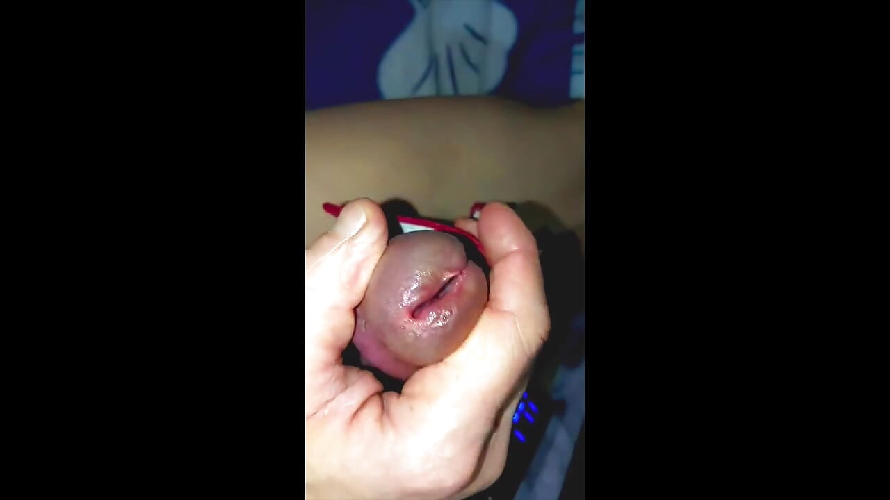 サーベイと電子刺激