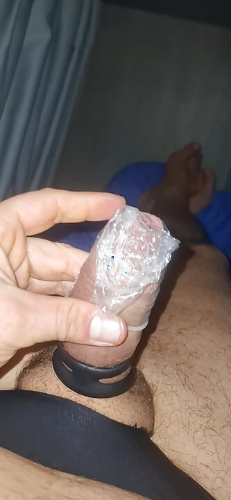 Normal penis