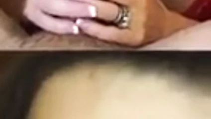 bj komplitasyon