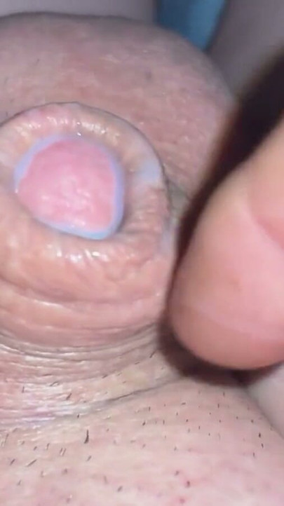 Tiny micropenis | Clip 1