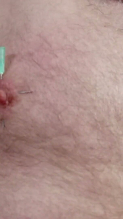 Needle in my nippels  .Nippel atack . Breast teasing | Clip 3