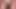 Penis başı enoki mantarlarıyla kaplı