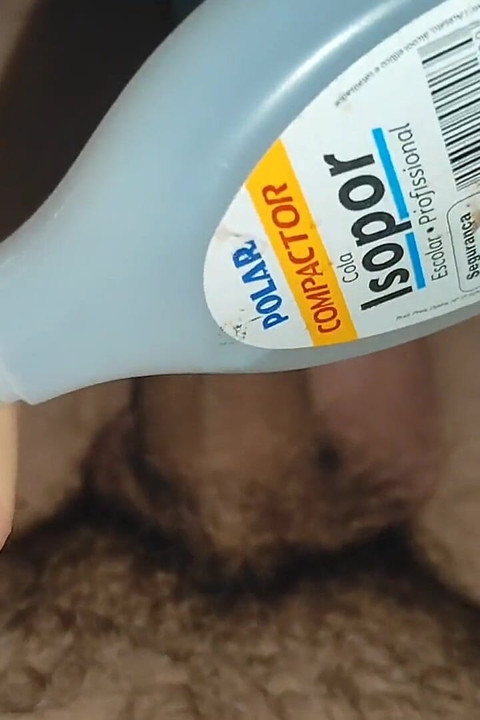 Extreme Incision of Glue Through the Glans with the Syringe.