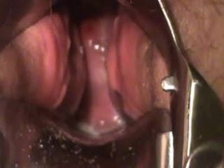 Bbw se masturba com espéculo mostra o orgasmo do colo do útero