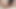 変態角質アジア人みだら015